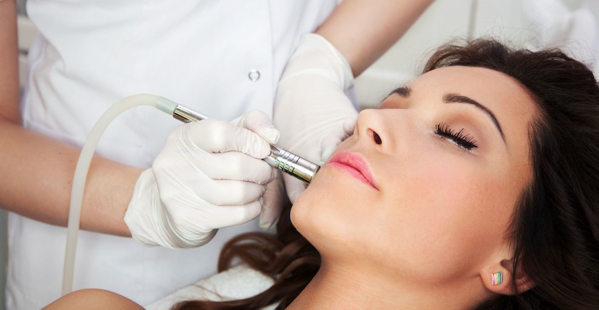 laser acne medical spa services